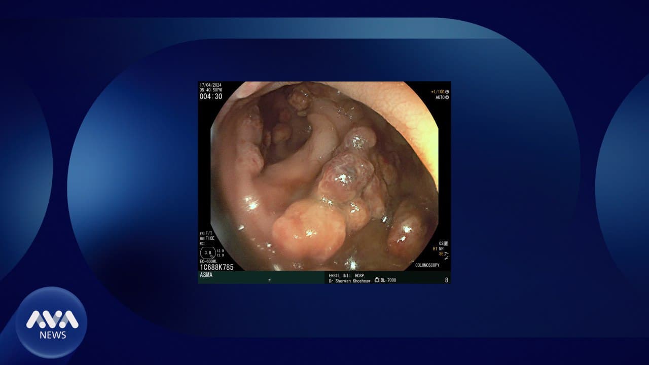 پزیشکێکی کورد نەخۆشییەکی دەگمەن دەستنیشان و چارەسەر دەکات