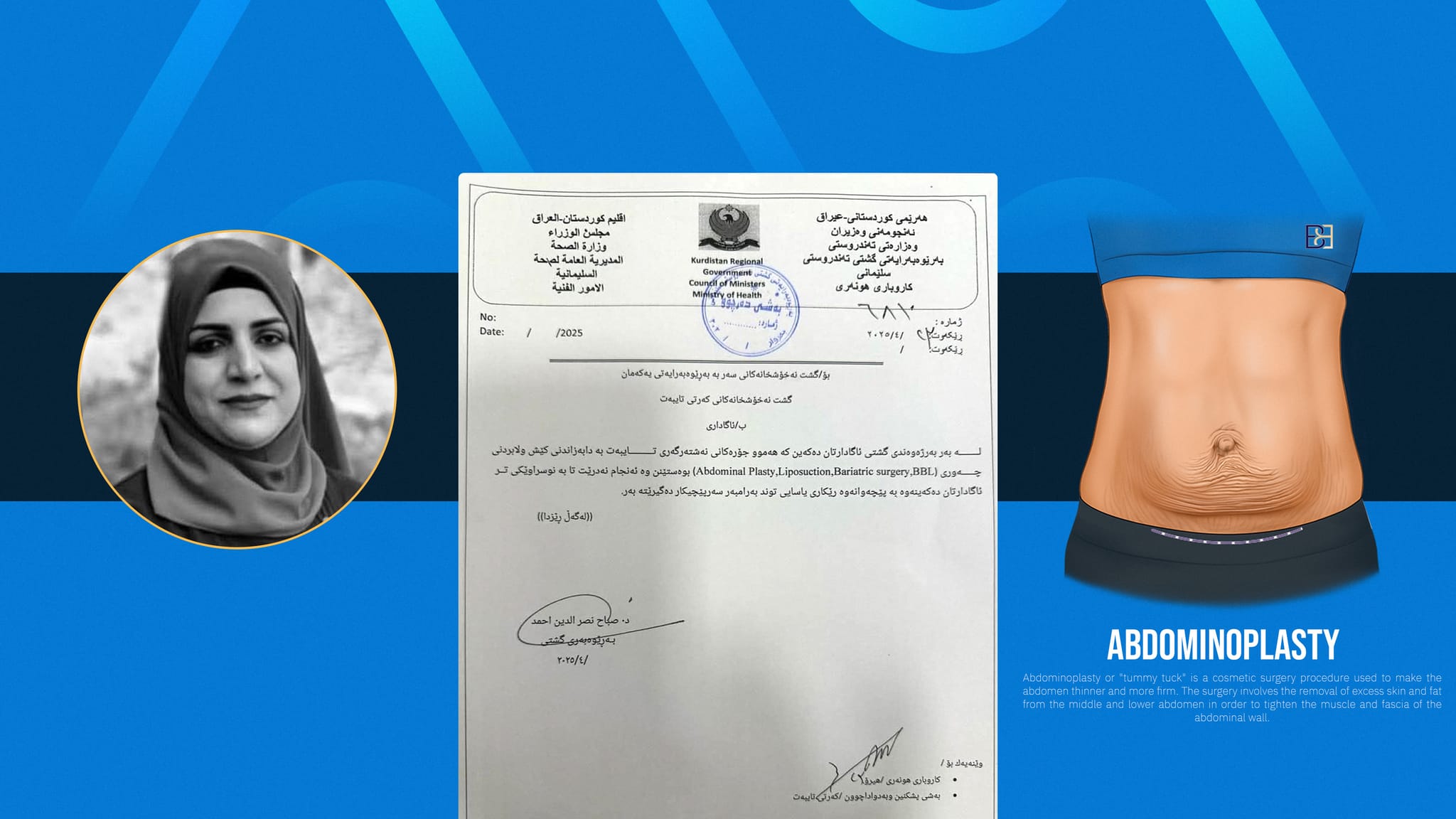 نەشتەرگەری دەرهێنانی چەوری لە سلێمانی قەدەغە دەکرێت