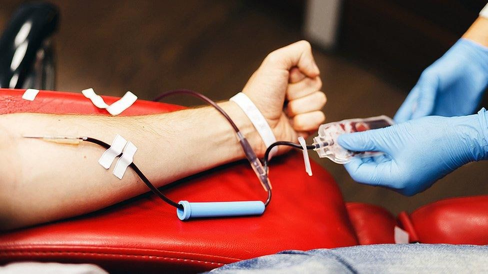 لە هەولێر بۆ سێ نەشتەرگەریی چاندنەوەی جگەر 340 یەکەی پێکهاتەی خوێن بەکارهات