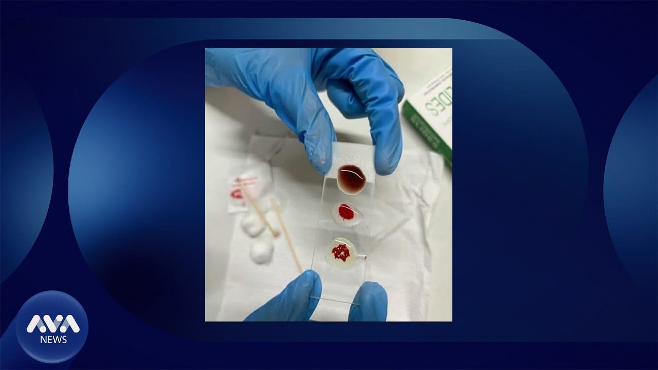 جۆرێکی نوێی خوێن لە جیهان دۆزرایەوە