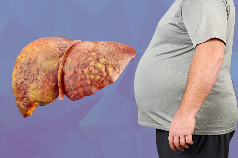 چەوریی جگەر، مرۆڤ تووشی چەندین نەخۆشیی دیکە دەکات