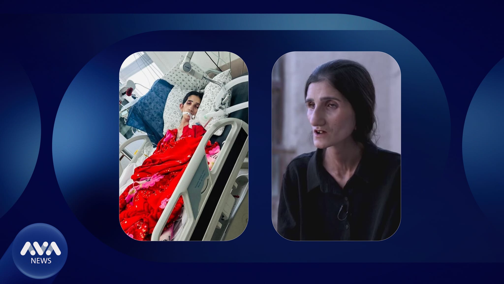 کچە کوردێکی ئێزدی ڕزگاربووی دەستی داعش بەهۆی ئەشکەنجەی زۆرەوە کۆچی دوایی کرد