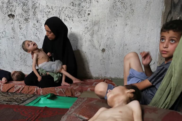 تەندروستیی غەززە: 10 کەسی دیکە بەهۆی برسیبووەنەوە گیانیان لەدەستداوە