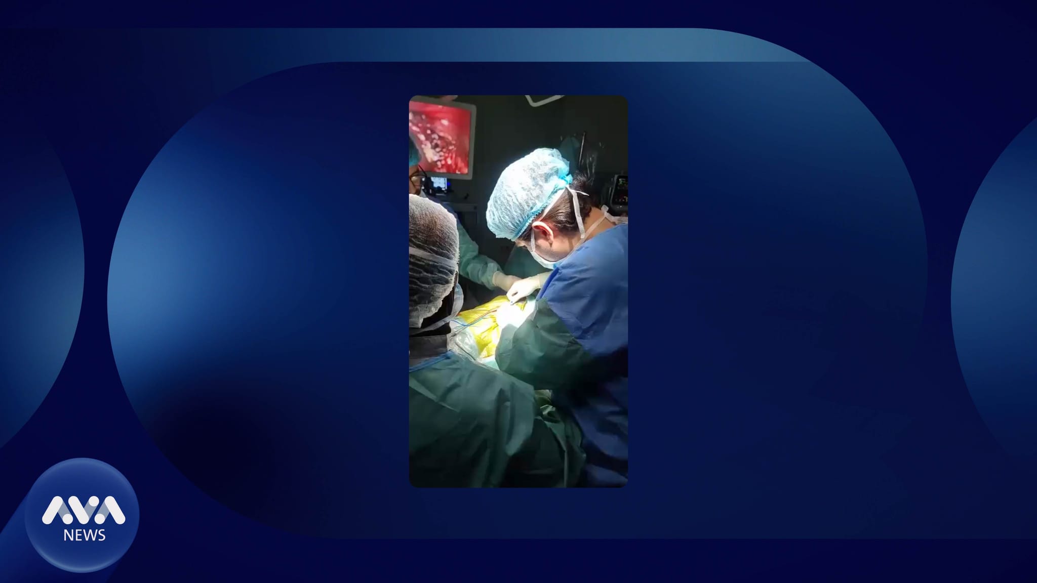 لە کوردستان بە سەرکەوتوویی نەشتەرگەری بۆ دەگمەنترین جۆری شێرپەنجەی سییەکان کرا