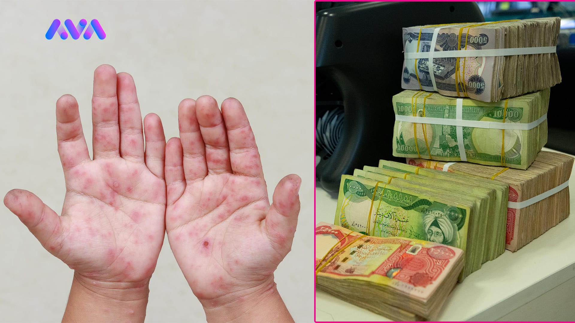 وەزارەتی دارایی ڕەتیدەکاتەوە پارەی هەڵمەتی کوتانی سورێژەیان بۆ هاتبێ