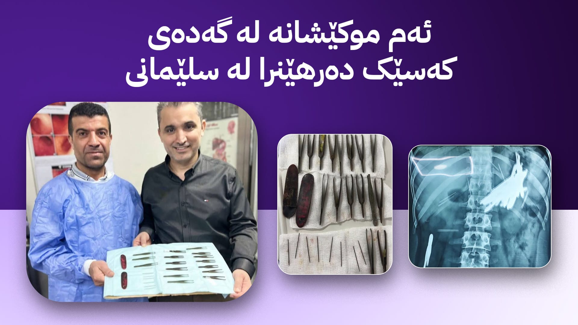 نەشتەرگەرییەکی دەگمەن؛ 16 موکێش و هەشت دەرزی لە سکی نەخۆشێک دەرهێنران