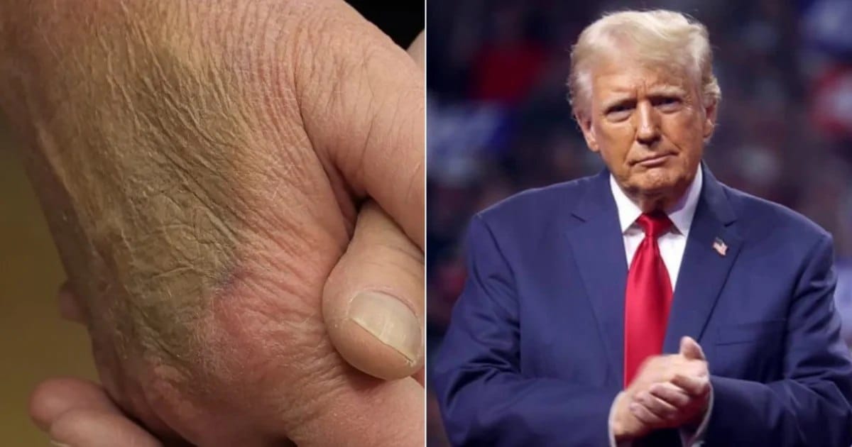 ترەمپ دیار نییە