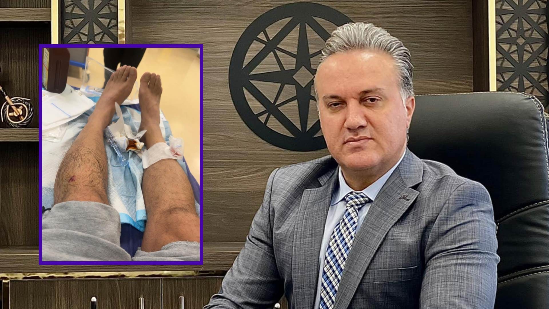 سەگ پەلاماری جێگری بەڕێوەبەری تەندروستی سلێمانی دا