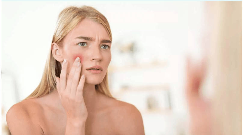 پسپۆڕانی تەندروستی: پیسبوونی هەوا یەكێک لە هۆکارەکانی سووربوونەوەی پێستە