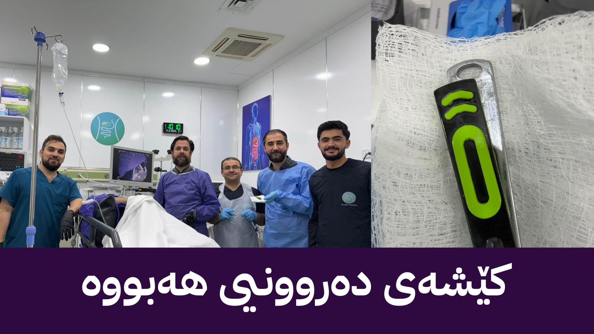 لە هەولێر نینۆکبڕێکی گەورە لە گەدەی گەنجێک دەردەهێنن