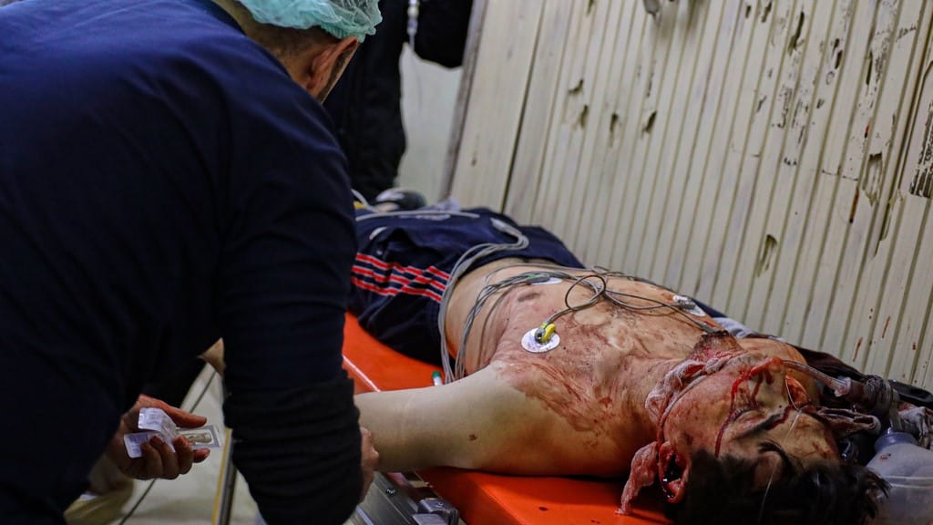 هاوسەرۆكی تەندروستیی گەڕەکە کوردییەکان: ڕێگەمان پێنادرێت برینداری زیاتر وەربگرین